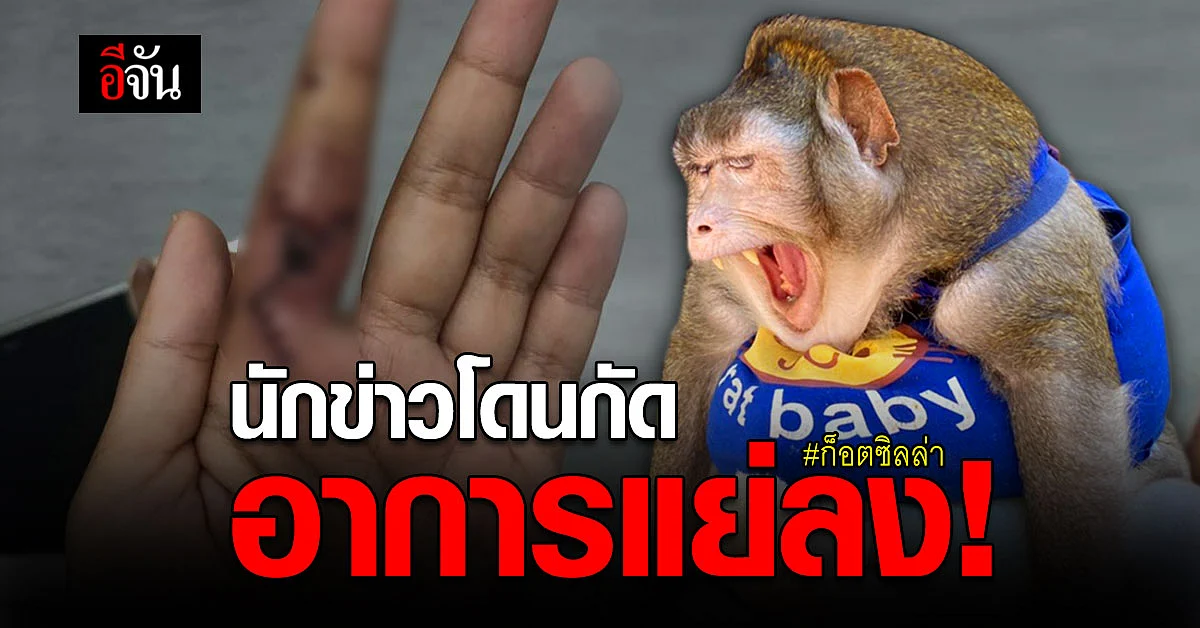 อาการแย่ลง ! นักข่าว โดน ลิงแสม ก็อตซิลล่า กัด แพทย์ เตรียมเจาะไขสันหลังตรวจเพิ่ม