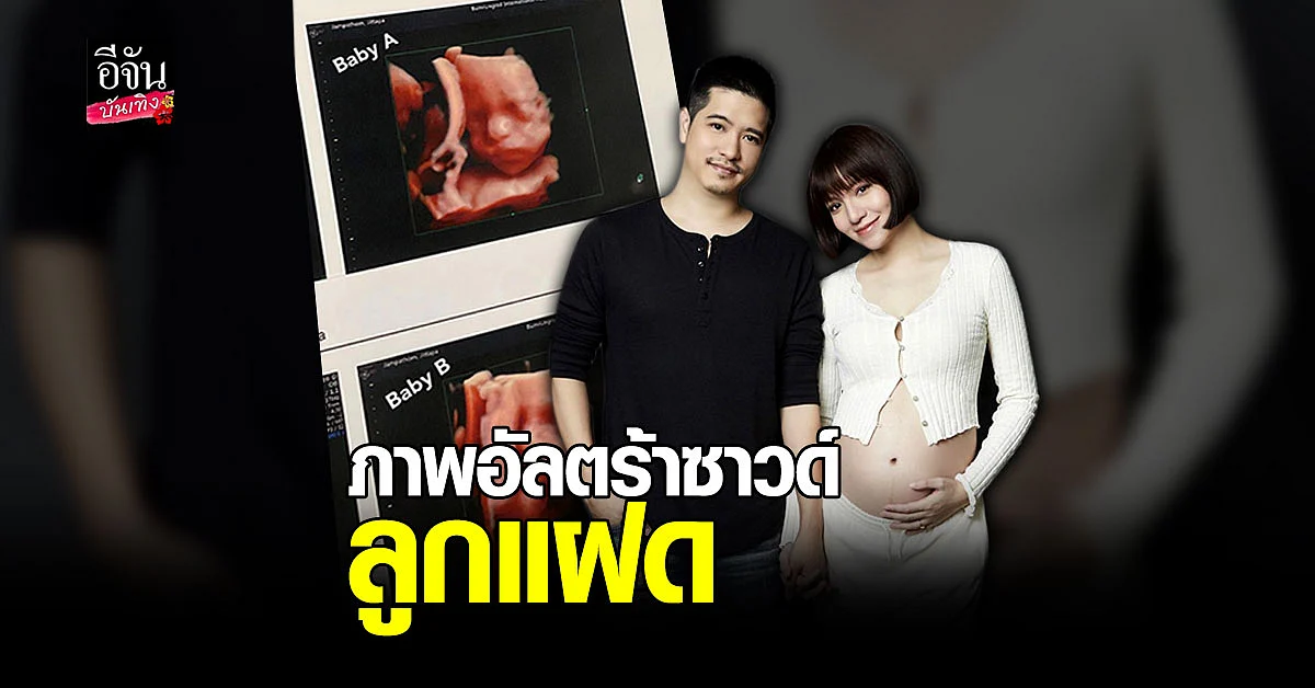 จ๊ะ จิตตาภา เผยภาพ อัลตร้าซาวด์ ลูกในท้องครั้งแรก ว้าว... แฝด น้อยจมูกโด่งมาก