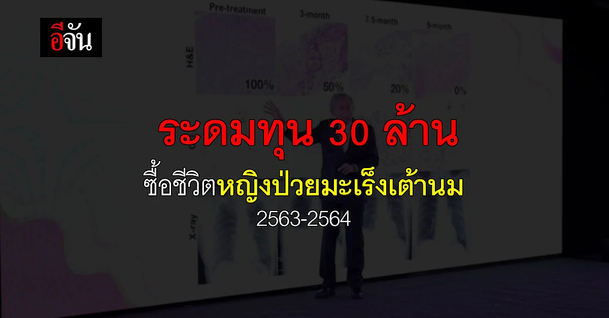 สังคมอีจัน ระดมทุน 30 ล้าน ซื้อชีวิต ผู้ป่วยมะเร็งเต้านม