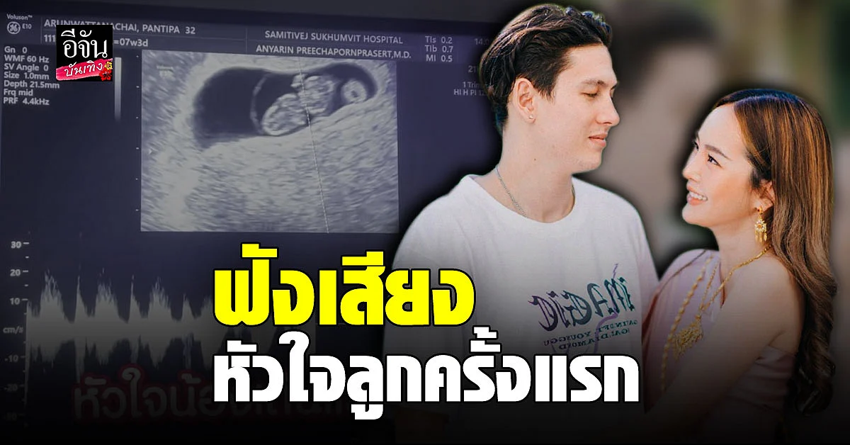 กวินท์ - ปุ้มปุ้ย ตื่นเต้นหนักมาก ไปตรวจครรภ์ ฟังเสียงหัวใจเบบี๋ครั้งแรก