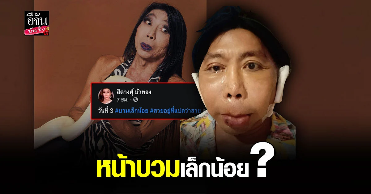 แม่สิตางศุ์ เผยภาพ หลัง โมหน้าใหม่ ได้ 3 วัน บอก บวมเล็กน้อย