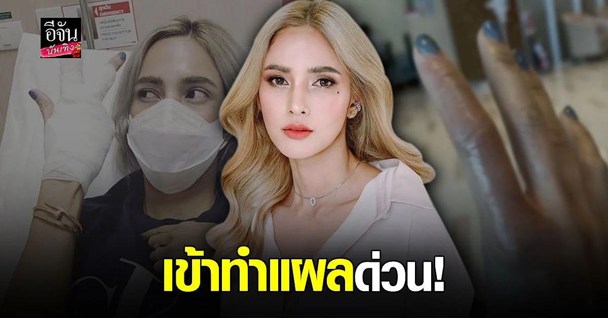อุ้ม ลักขณา ทอดไก่ให้ลูกสาว แต่ดันโดนทอดซะเอง น้ำมันร้อนลวกมือเต็ม ๆ