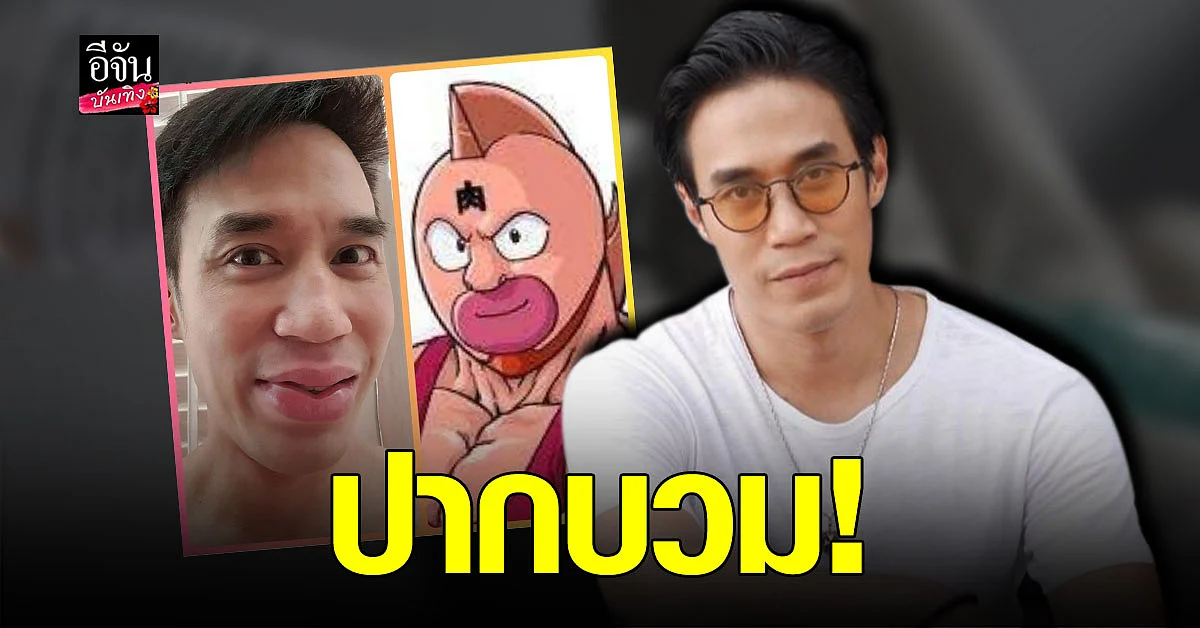 ดอม เหตระกูล เผย ผลข้างเคียง หลัง ฉีดวัคซีน เข็มแรก ปากบวม