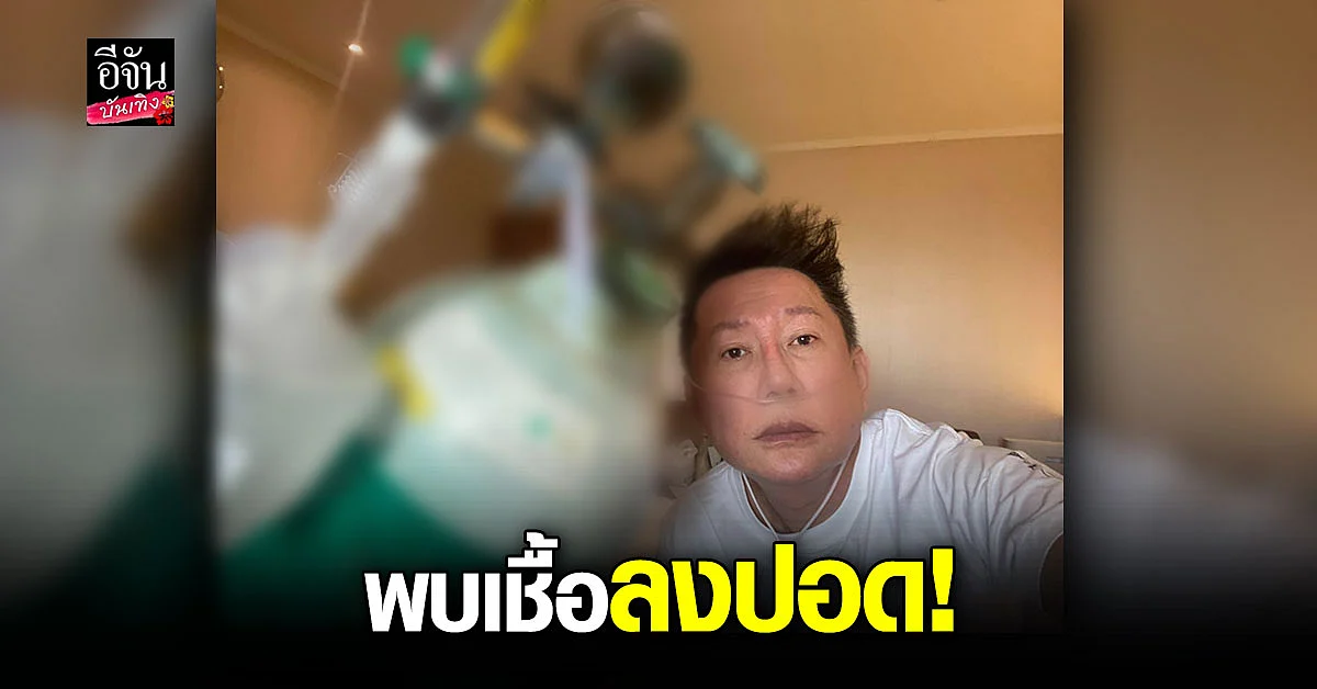 ณวัฒน์ อัปเดตอาการ โควิด-19 ล่าสุด พบเชื้อบางส่วนลงปอดแล้ว!