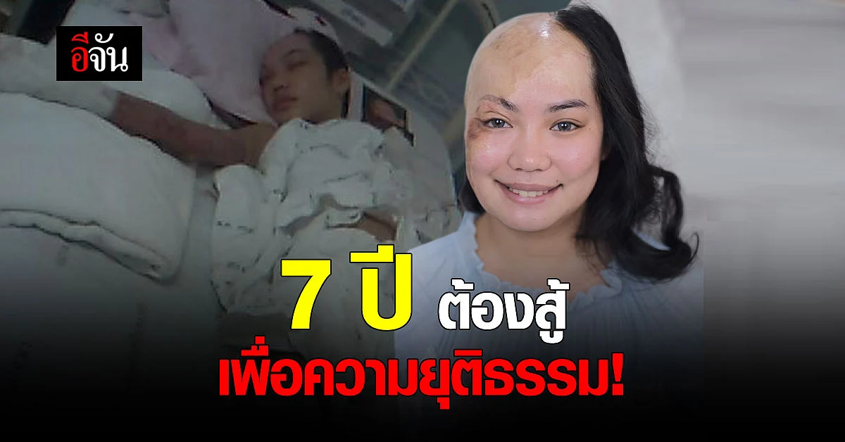 เปิดใจ เจ้าสาวเสียโฉม สู้คดี 7 ปี รถสิบล้อพุ่งชน เผาเธอทั้งเป็น