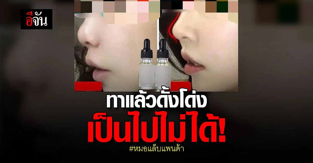 หมอแล็บเตือน ! อย่าลงเชื่อเซรั่มดั้งโด่ง ไม่มีจริง!