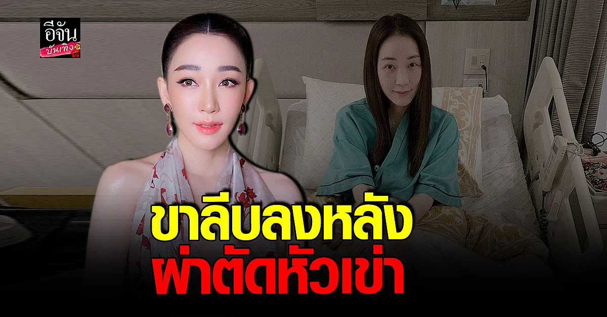 ตู่ ปิยวดี เผยภาพขาขวาลีบหลังจากผ่าตัดหัวเข่า