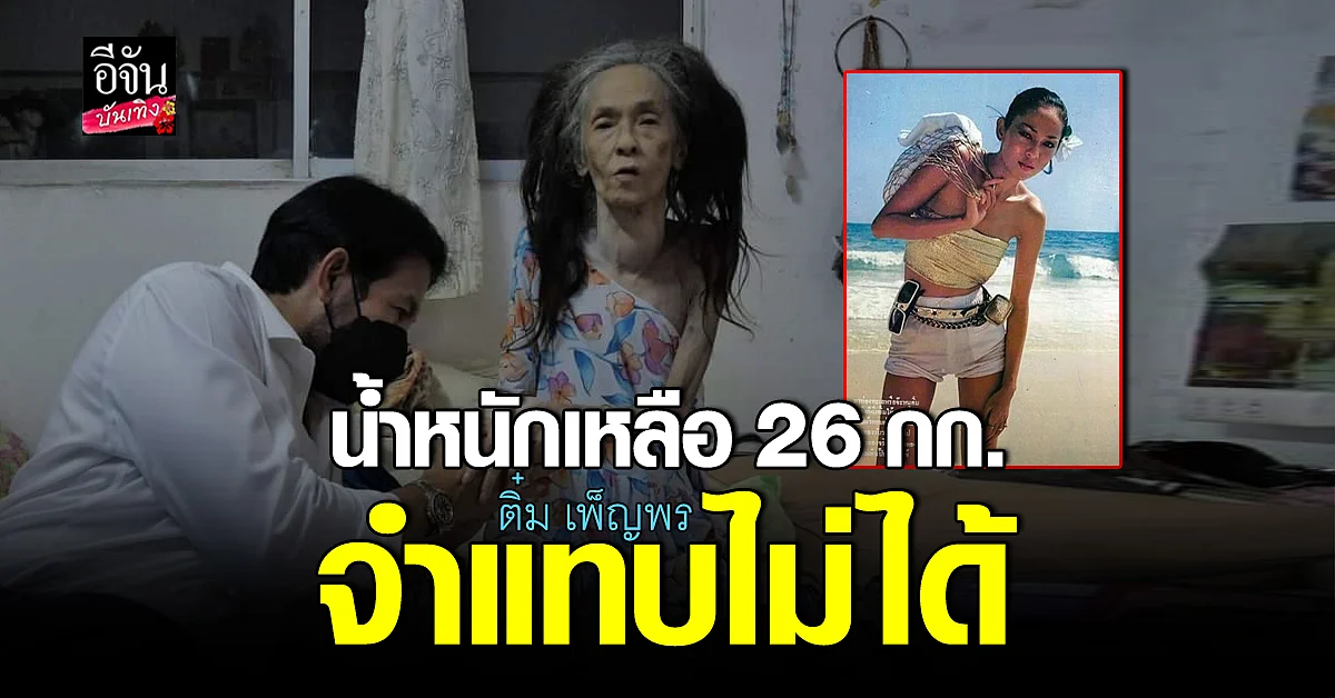 อดีตนางแบบ ชื่อดัง ติ๋ม เพ็ญพร ป่วยหนัก จนจำแทบไม่ได้