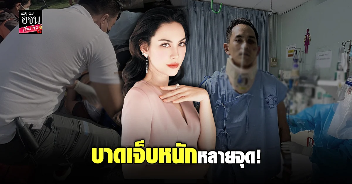 แมท ภีรนีย์ อัปเดตอาการเจ็บ สงกรานต์ เผยบาดเจ็บหนักหลายจุด