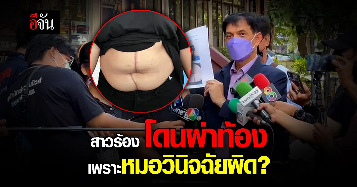 สาว 22 ร้อง หมอ วินิจฉัยโรคผิด ต้องผ่าตัดท้อง ทั้งที่ไม่ป่วย ?