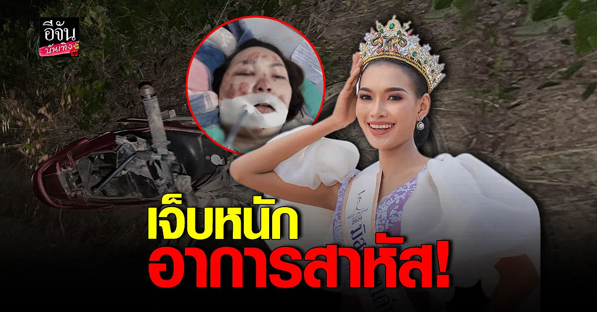 อากี้ เกษร รถจักรยานยนต์ประสานงารถกระบะ อาการสาหัส