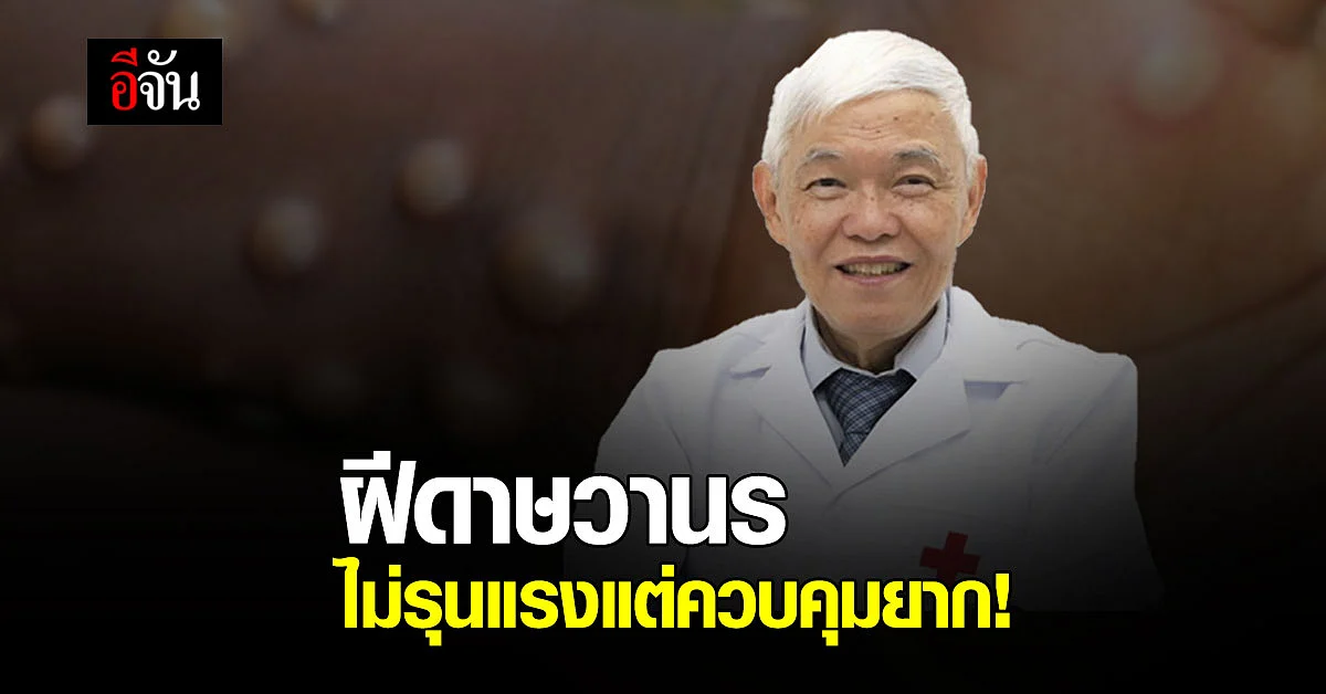หมอยง แนะจับตา! ฝีดาษวานร ย้ำโรคไม่รุนแรงแต่ควบคุมยาก