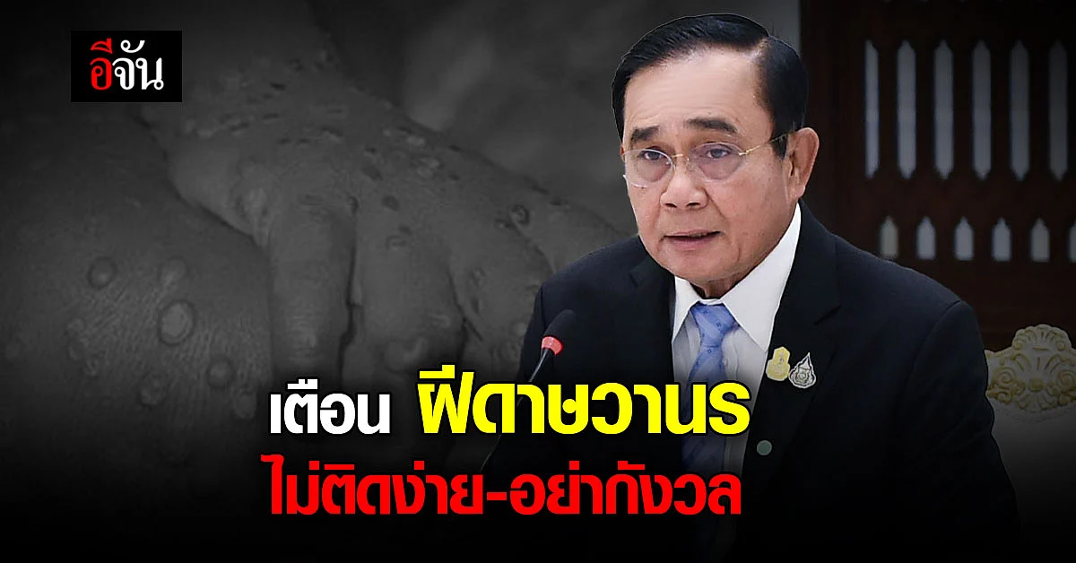 นายกฯ เตือน อย่ากังวลฝีดาษวานร ไม่ติดต่อง่าย แต่เลี่ยงพฤติกรรมเสี่ยง