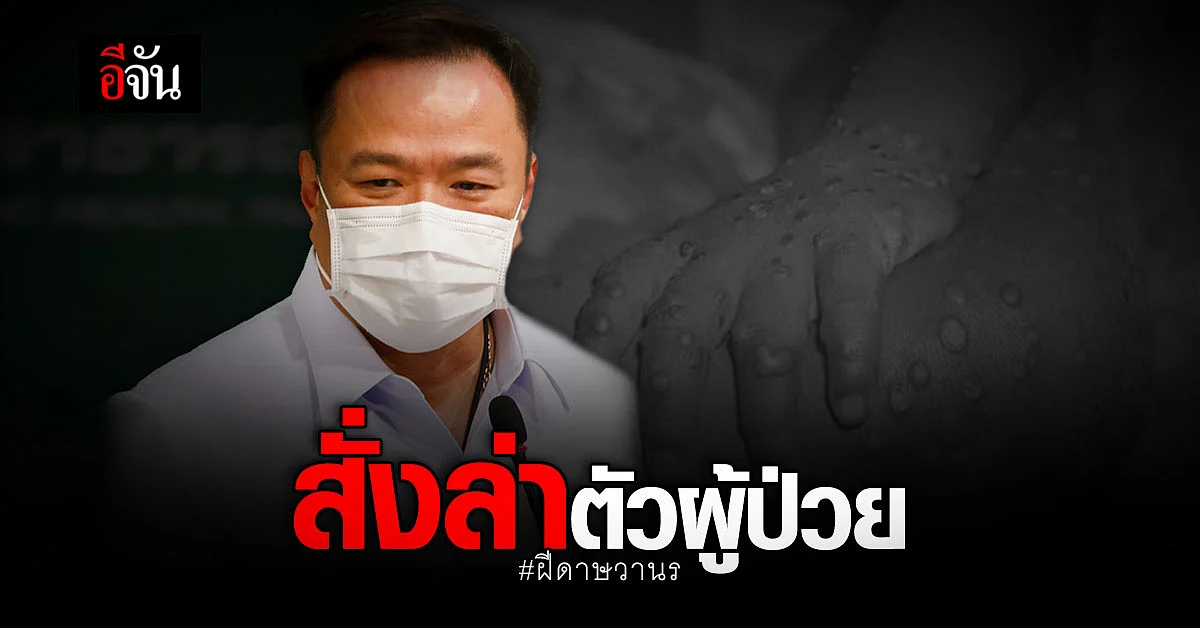 อนุทิน สั่ง ล่าตัวผู้ป่วย ฝีดาษวานร รายแรกในไทย ชี้ อาจเนรเทศออกจากไทย