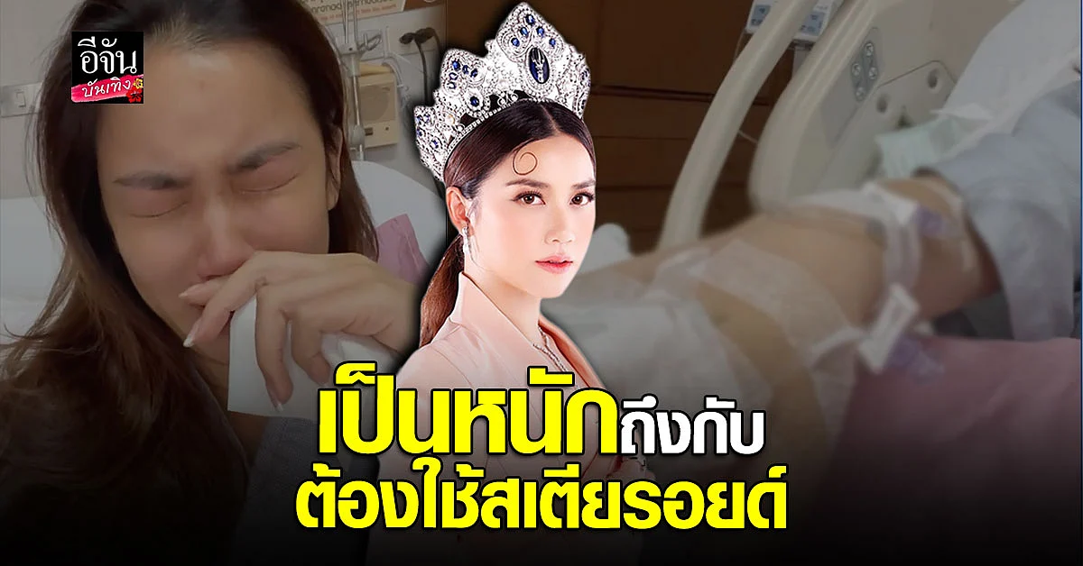 หมิง จิรกิติยา เล่าทั้งน้ำตา ป่วยเป็น โควิด หนักจนต้องแอดมิท