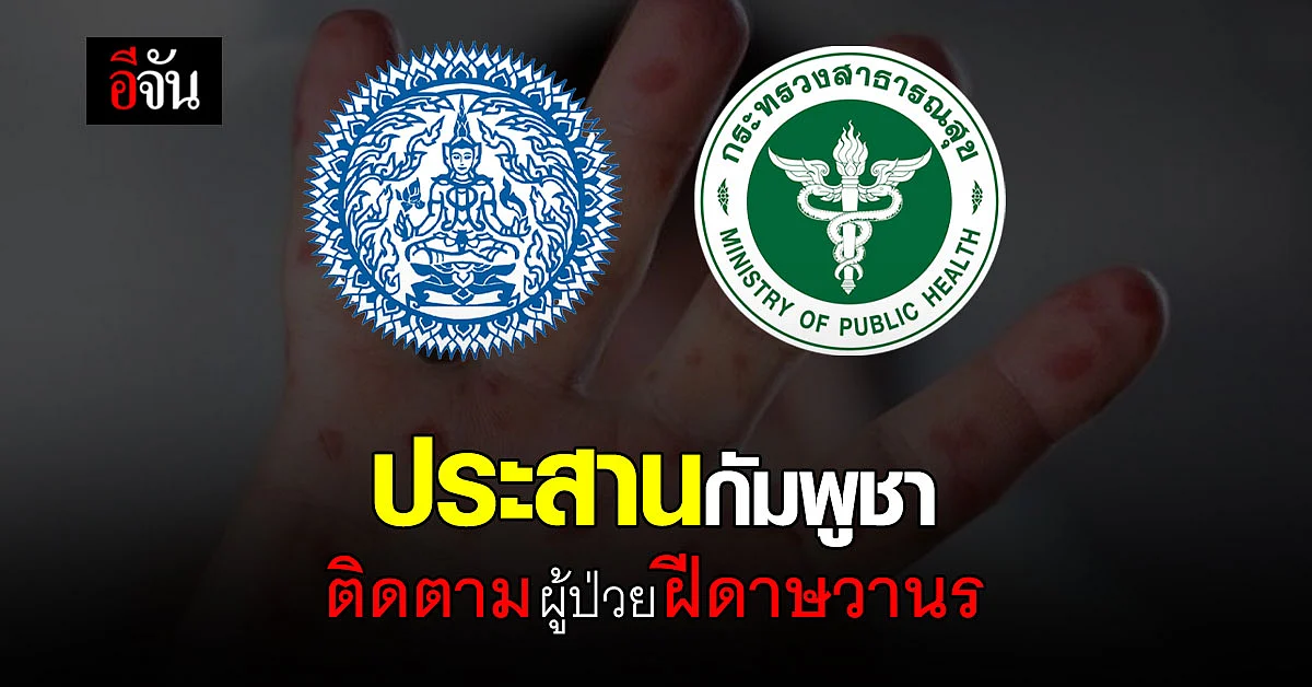 สธ. ร่วม กต. ประสานกัมพูชา ติดตามผู้ป่วยฝีดาษวานร หลังหลบหนีข้ามแดน