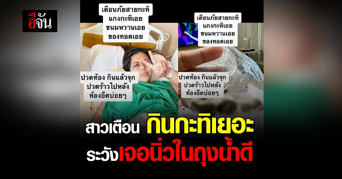 สาวเตือนภัย! อย่าคิดว่าไม่เป็นไร สายกะทิ ชอบ ของมัน อันตรายถึงชีวิต