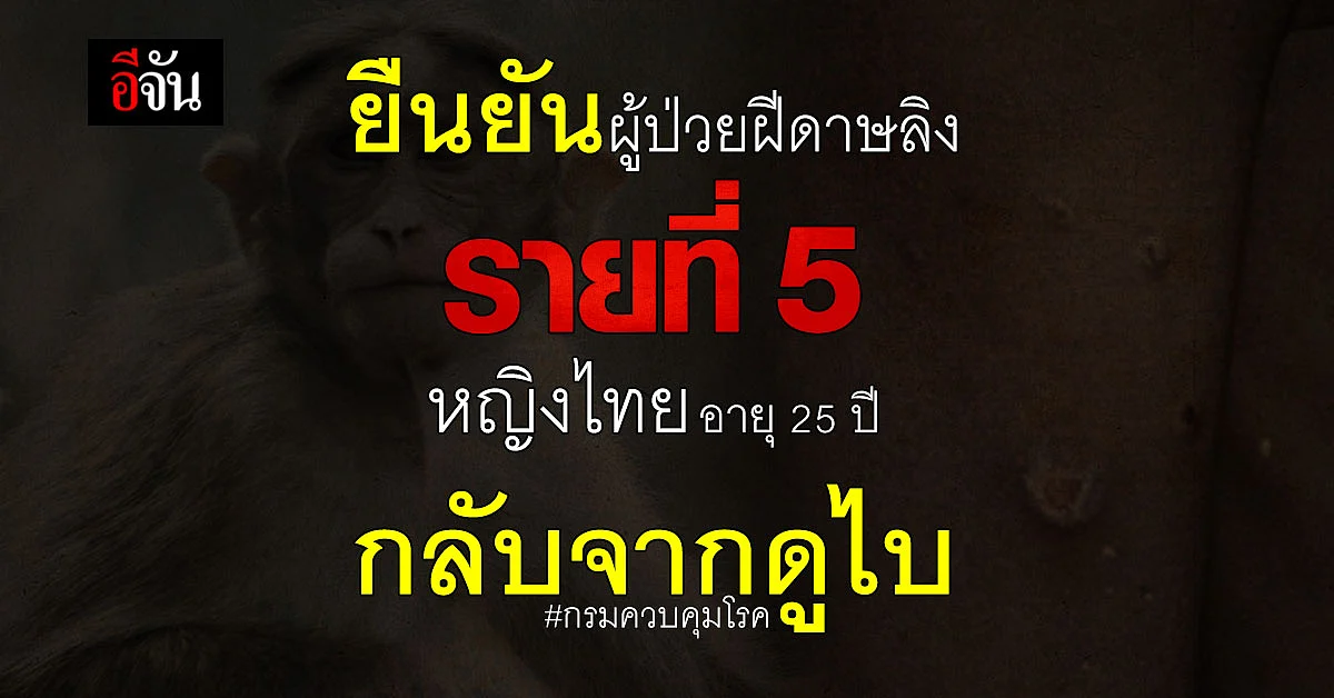 กรมควบคุมโรค ยืนยันผู้ป่วยฝีดาษลิง รายที่ 5