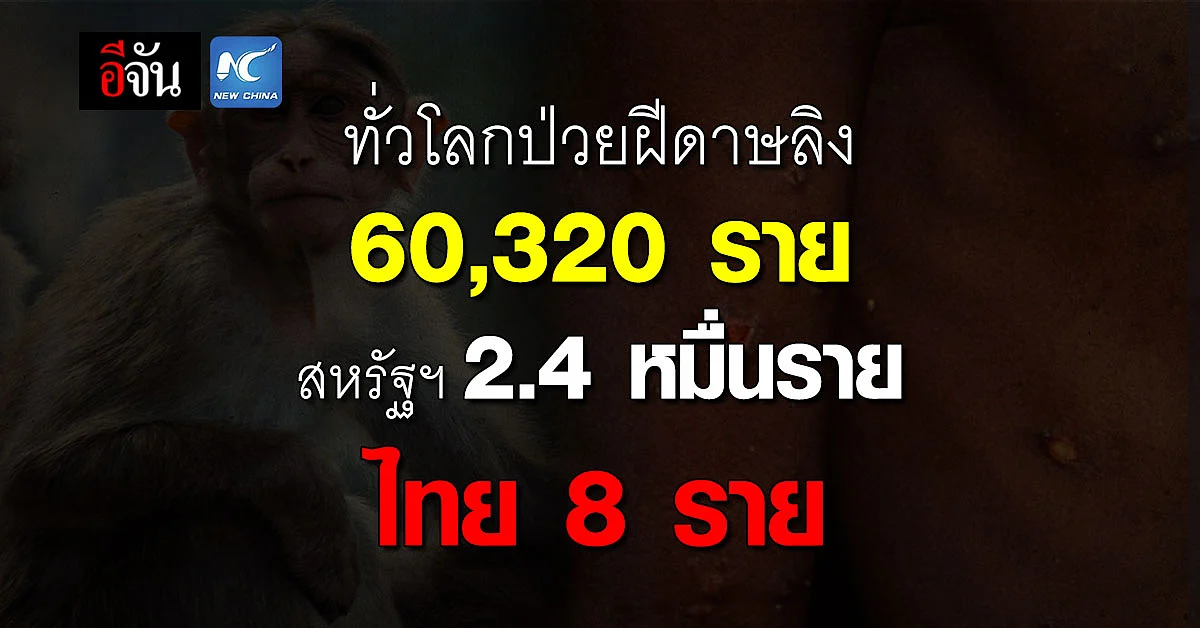ทั่วโลกติดฝีดาษลิงแล้ว 60,320 ราย