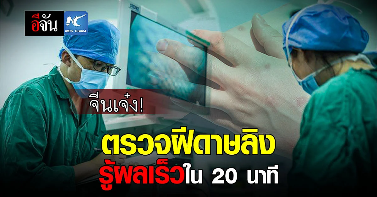 จีนพัฒนาวิธีตรวจ “ฝีดาษลิง” แบบรู้ผลใน 20 นาที