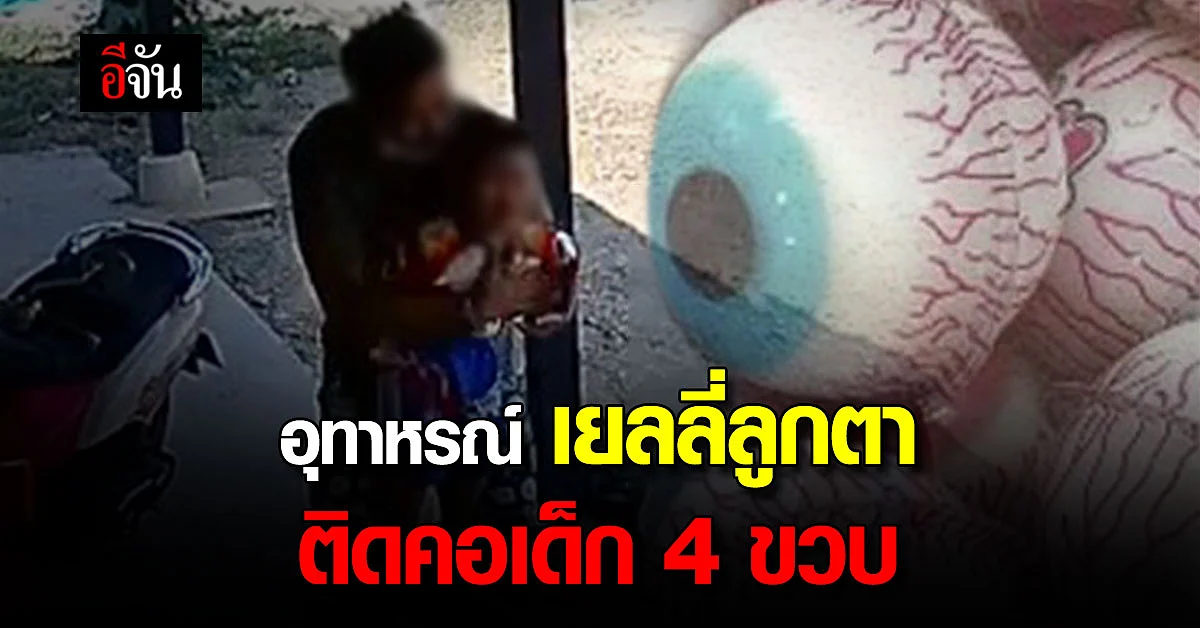 อุทาหรณ์ เยลลี่ลูกตาพลาดติดคอเด็ก เกือบช่วยไม่ทัน