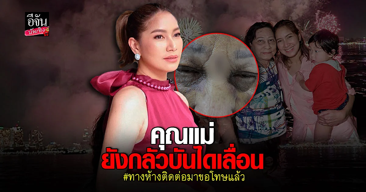 เบนซ์ - มิค เปิดใจหลังแชร์อุทาหรณ์คุณแม่ประสบอุบัติเหตุ