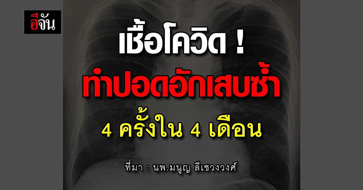 นพ.มนูญ เผยข้อมูล เชื้อโควิดทำปอดอักเสบซ้ำแล้วซ้ำอีก