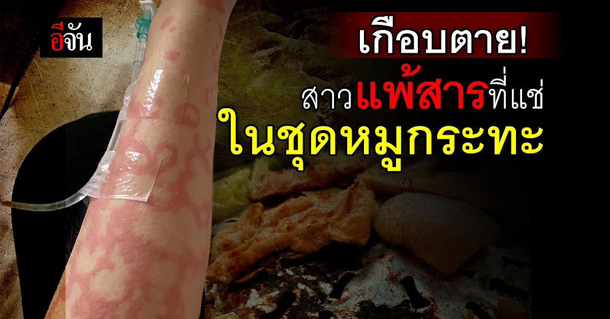 เกือบขิต! สาวเตือนภัย แพ้สารเคมีที่แช่ในชุดหมูกระทะ