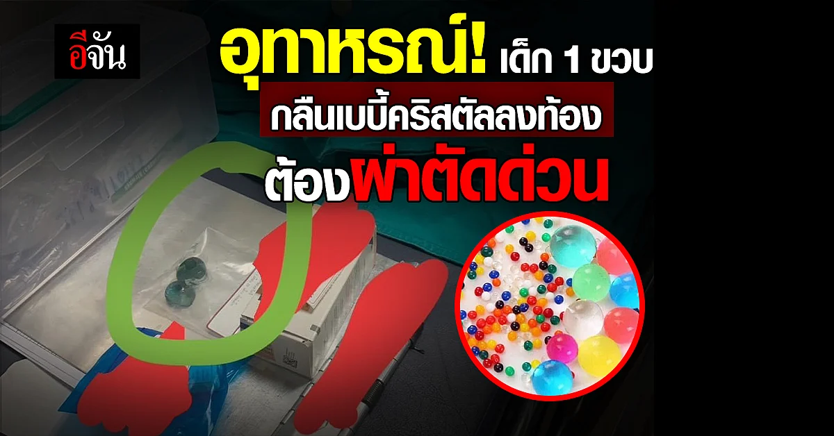 อุทาหรณ์! หมอเร่งผ่าด่วน หลังเด็ก 1 ขวบ คว้าเบบี้คริสตัลกลืนลงท้อง