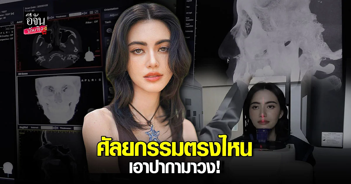 ใหม่ ดาวิกา งัดหลักฐานตอบกลับเรื่องทำ ศัลยกรรม