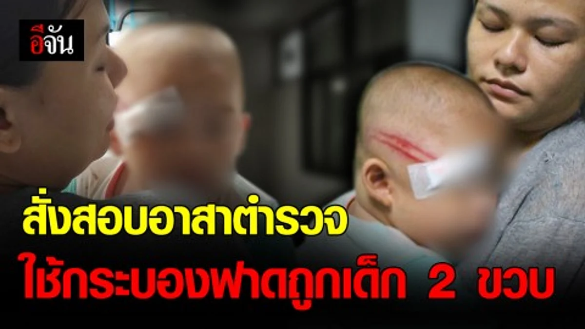 ตร.ตั้งคณะกรรมการสอบ เหตุอาสาใช้กระบองฟาดถูกเด็ก 2 ขวบสลบ
