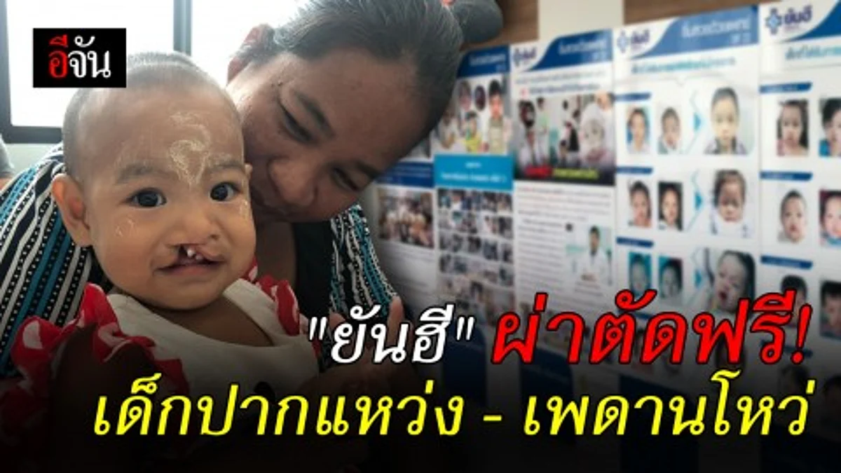 รพ.ยันฮี เดินหน้ารักษาหนูน้อยปากแหว่ง - เพดานโหว่ ฟรี! ปีที่22 เผย ปีนี้ตั้งเป้าหมายอีก 100 ราย