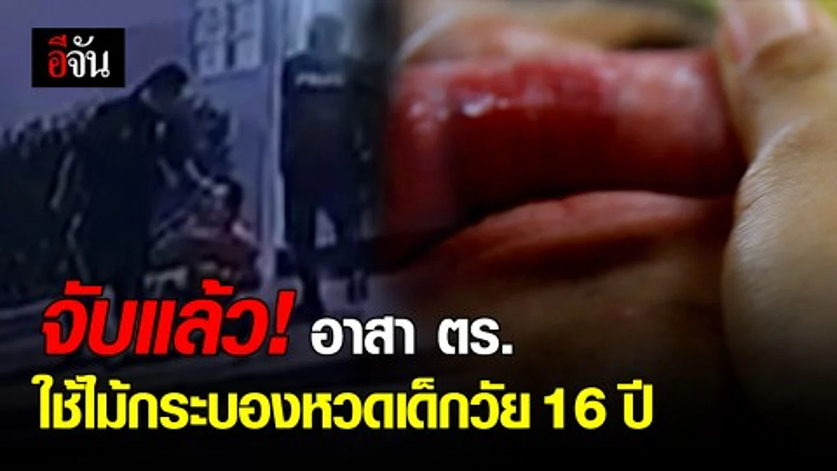 รวบอาสาตำรวจ ใช้ไม้กระบองฟาดท้ายทอย- เตะปาก เด็กวัย 16 ปี อ้างจับแว้นแต่พลั้งมือ