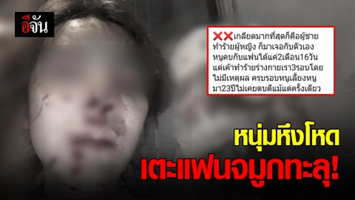สาวสุดจะทน!!! โพสต์โดนแฟนหนุ่มทำร้าย เลือดท่วมหน้า ซิลิโคนจมูกทะลุ เพราะหึงหวง