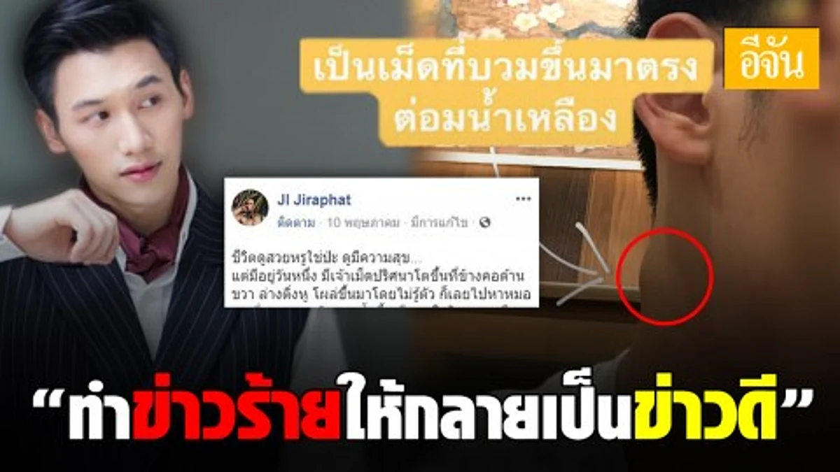 หนุ่มโพสต์รำลึกถึงตัวเอง ที่เคยป่วยเป็นมะเร็งหลังโพรงจมูก แต่ปัจจุบันหายดีและกลับมาใช้ชีวิตให้เต็มที่ เป็นข้อคิดและกำลังใจให้กับทุกคนที่สู้โรคร้าย
