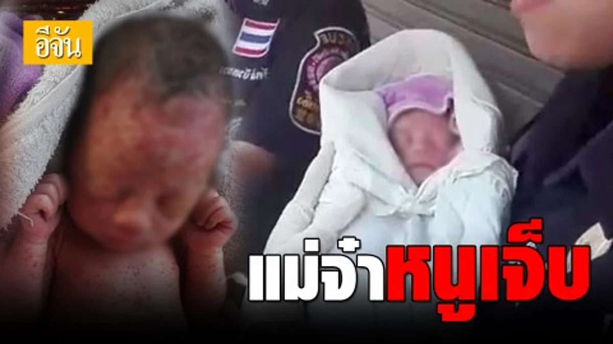 พบทารกน้อยเพศหญิง ถูกทิ้งในซอยคุ้มเกล้า 21 ย่านฉลองกรุง สภาพผื่นเต็มตัวจากยุงรุมกัด