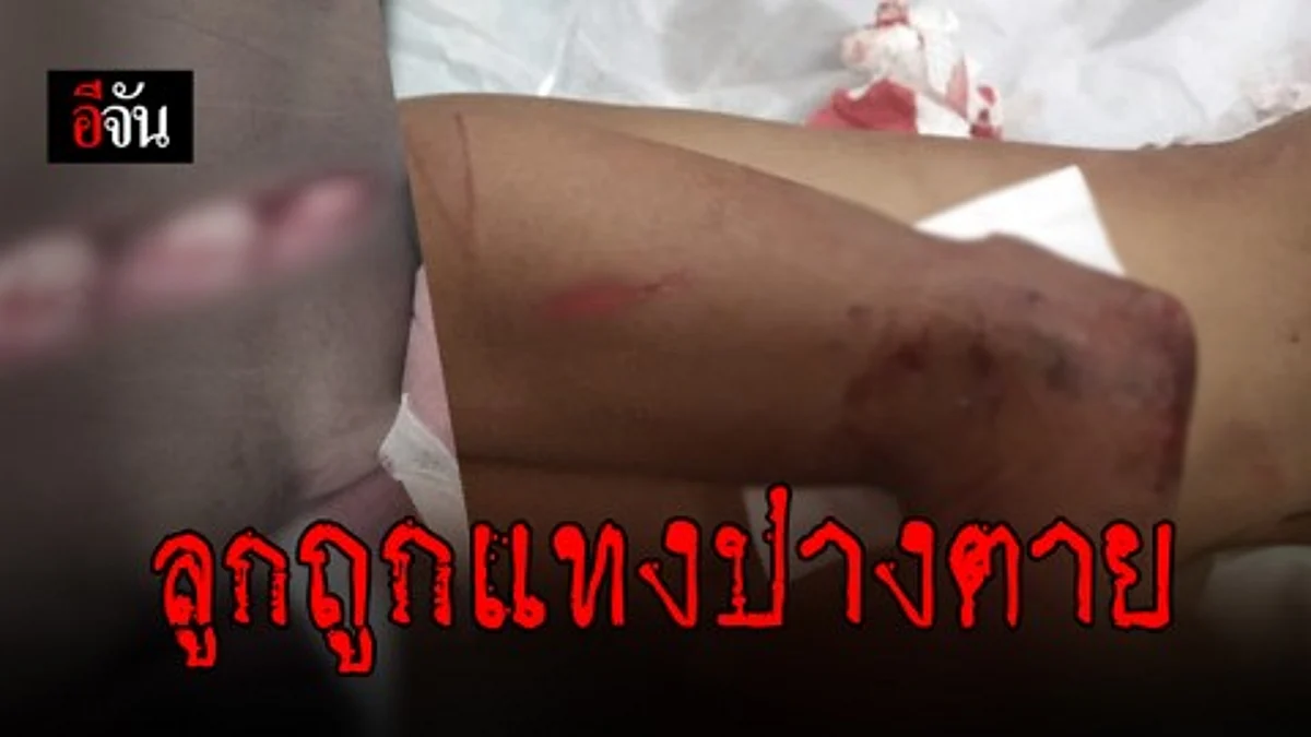 แม่ร้อง ลูกโดนทำร้ายแต่ตำรวจยังจับคนร้ายไม่ได้ วอนโซเชียลช่วยแจ้งเบาะแส