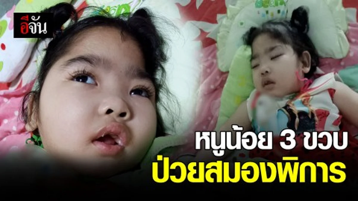 “น้องใบเตย” หนูน้อยวัย3 ขวบ ป่วยพิการทางสมอง ครอบครัวขัดสน - แม่วอนช่วยเหลือค่ารักษา