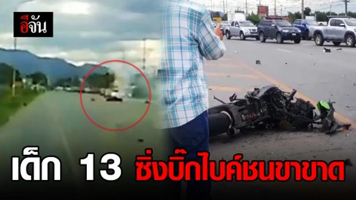 เปิดภาพเด็ก 13 ซิ่งบิ๊กไบค์ชนสนั่น บาดเจ็บข้อเท้าขาด