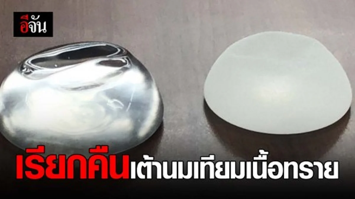อย.แถลง เรียกคืนเต้านมเทียมซิลิโคนเนื้อทราย เสี่ยงอันตราย
