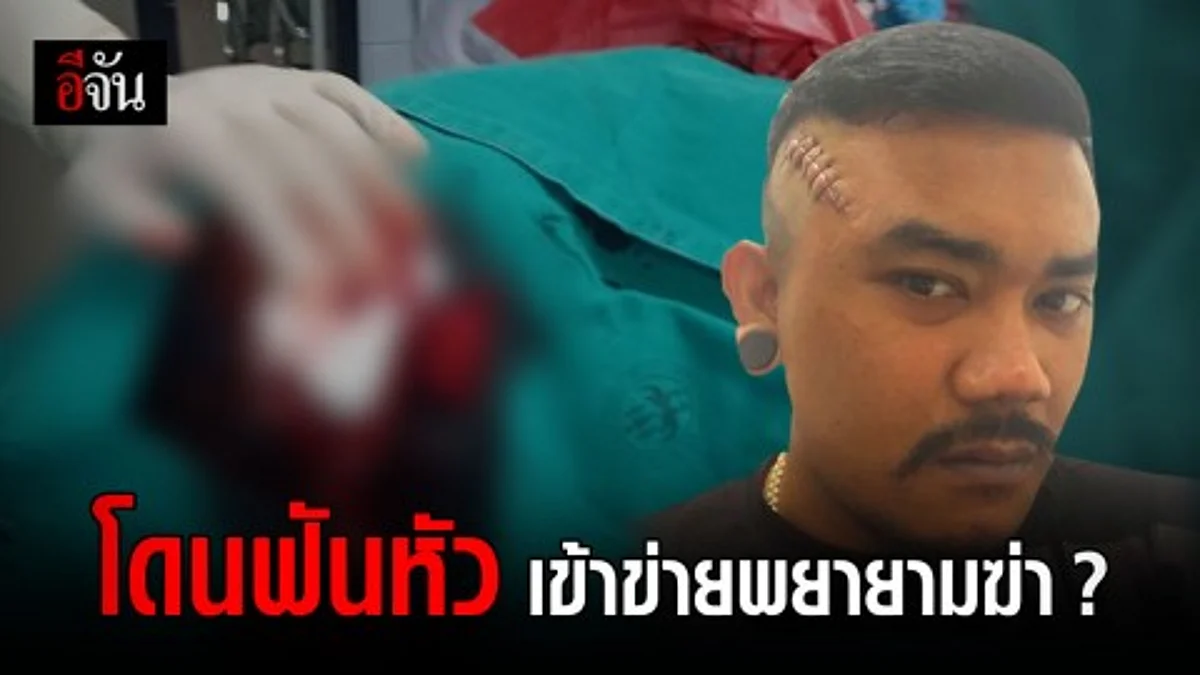 ลูกเพจร้อง โดนฟันหัว เเต่ผู้ก่อเหตุกลับโดนเเจ้งเเค่ข้อหาทำร้ายร่างกาย