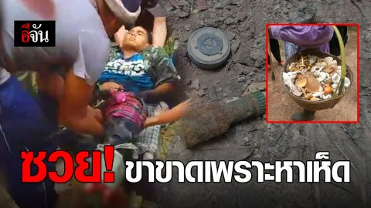ชาวบ้านเหยียบกับระเบิดขาขาด ขณะเดินหาเห็ดในป่า