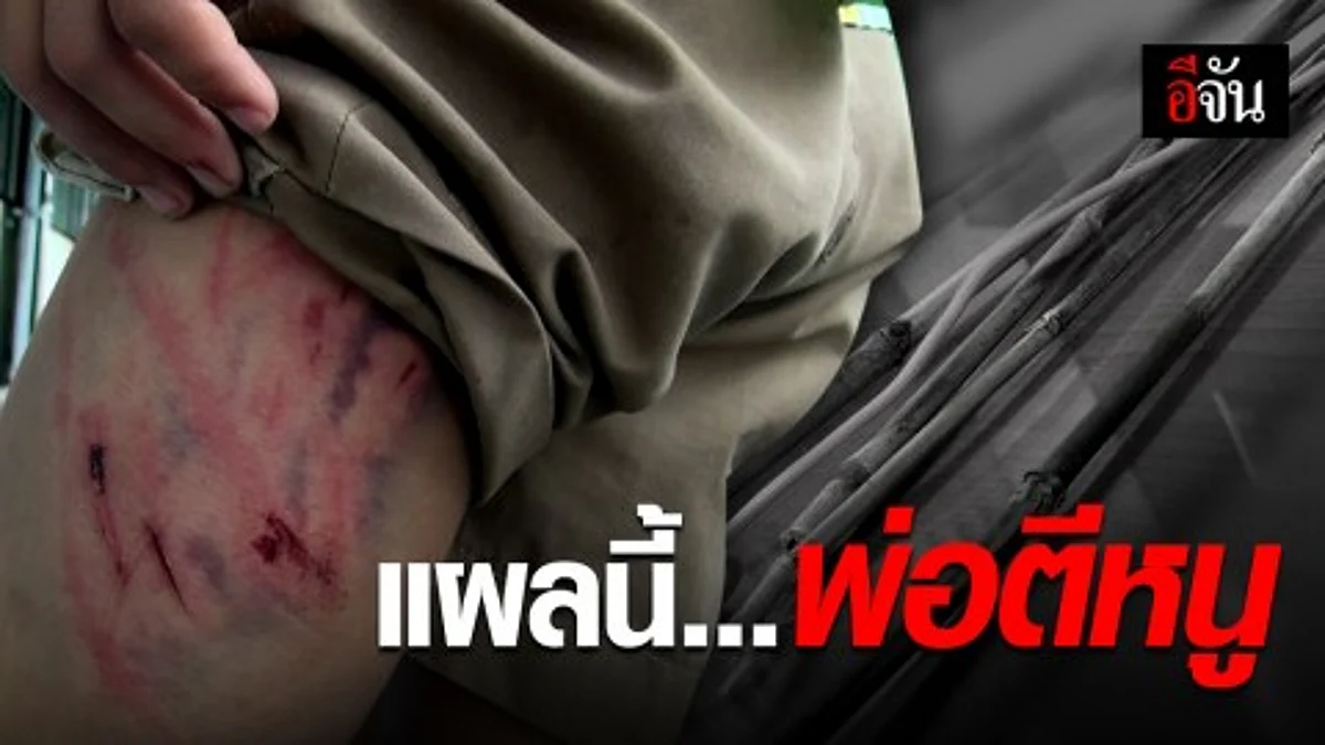 เด็ก 10 ขวบถูกพ่อตี เพราะเอานมไปขายอยากซื้อประทัดเล่นกับเพื่อน