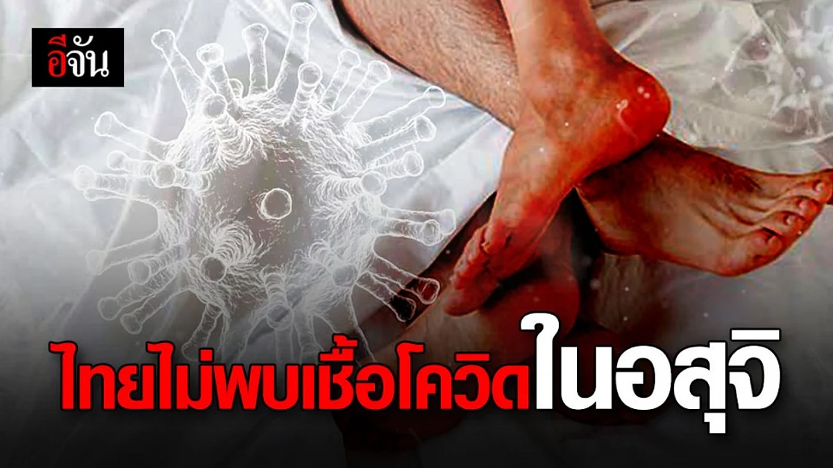 ไทยยังไม่พบเชื้อโควิด-19 ในน้ำอสุจิ