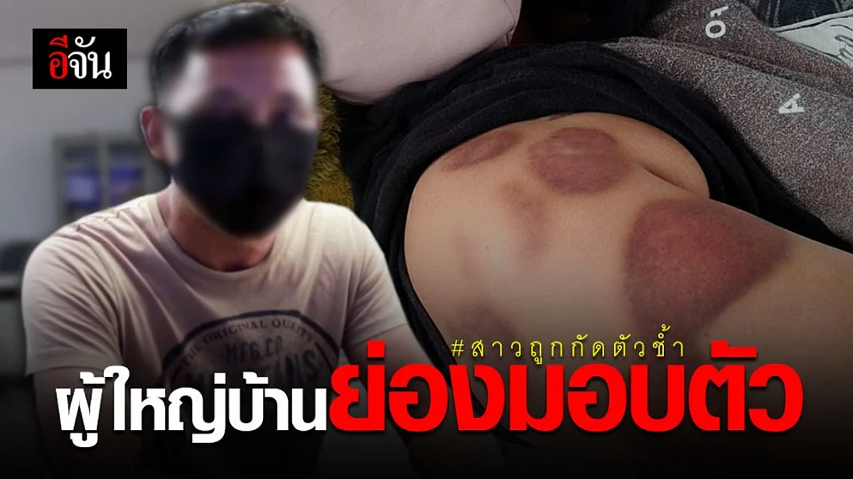 คืบหน้าสาวสุรินทร์ร้องสื่อ ถูกผู้ใหญ่บ้านอนาจาร กัดช้ำทั่วตัว
