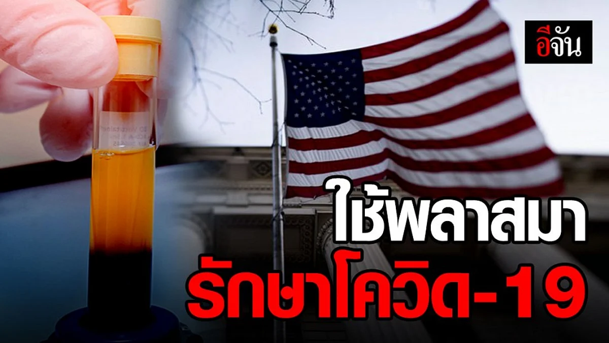 อย.สหรัฐฯ ไฟเขียว! ใช้พลาสมารักษาผู้ป่วยโควิด-19