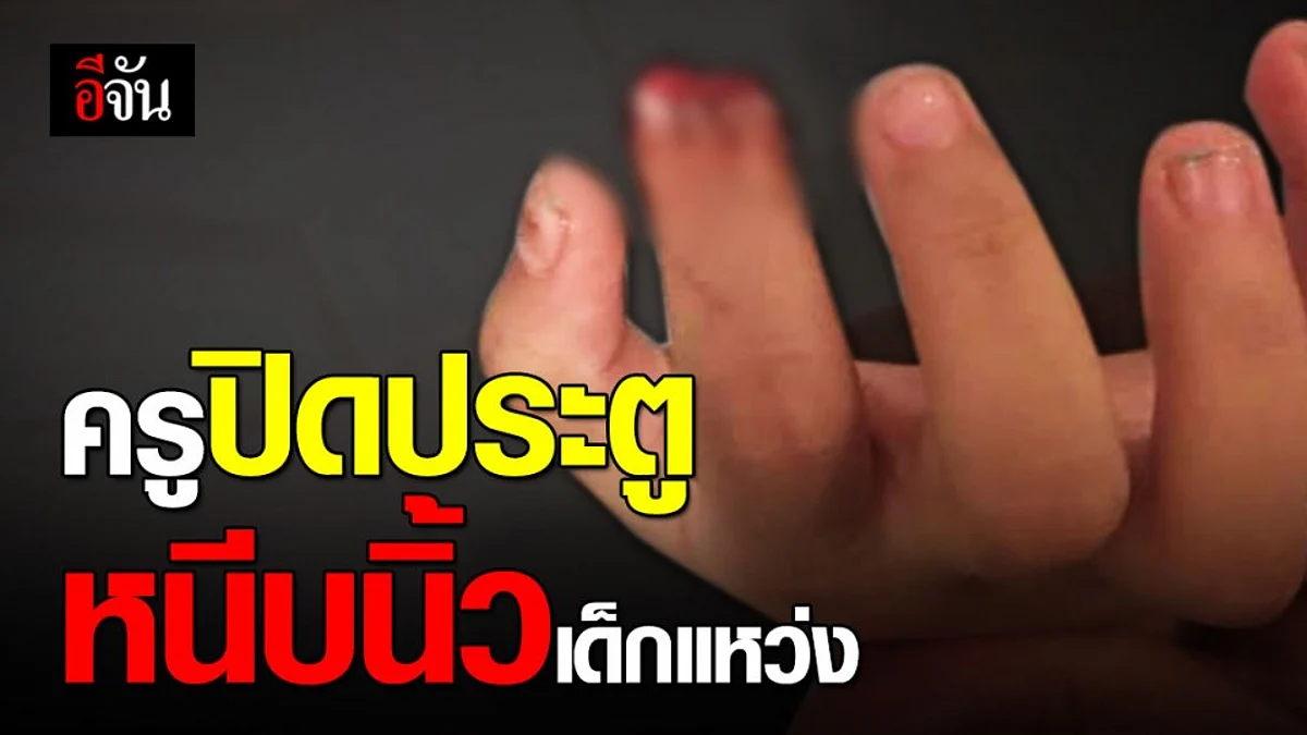สาวโพสต์ ครูปิดประตูหนีบนิ้วลูกของพี่สาว จนนิ้วแหว่ง จี้ รร. รับผิดชอบ