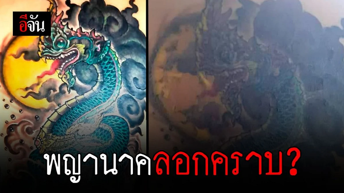 ส่อแววไม่จบ! สาวสักพญานาค ทับงูเขียวผื่นคันขึ้น