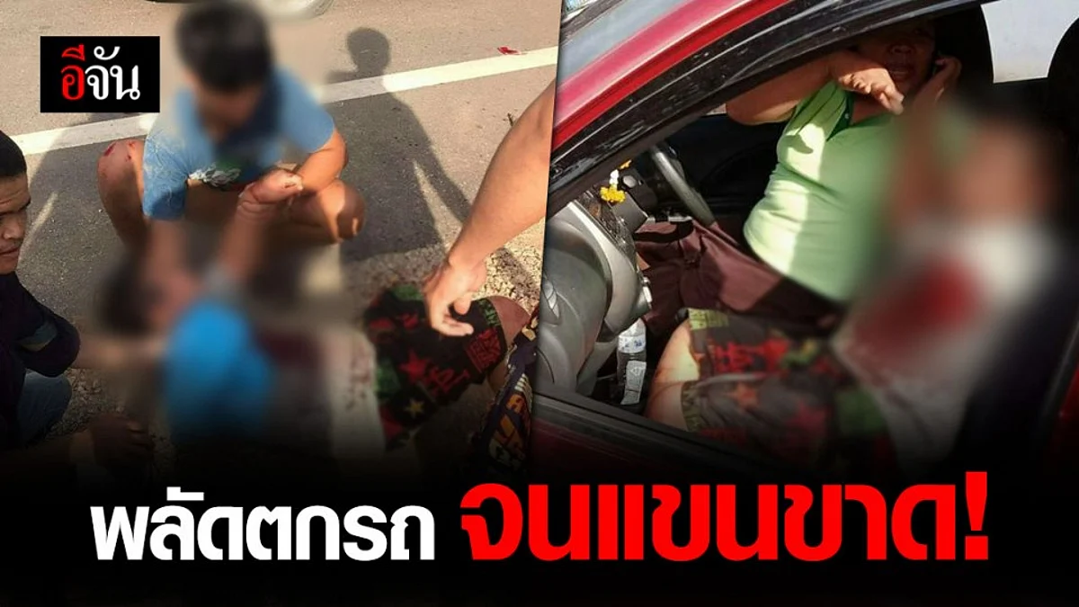 พี่ชายเล่านาที "น้องแมนยู" พลัดตกรถ จนแขนซ้ายขาด