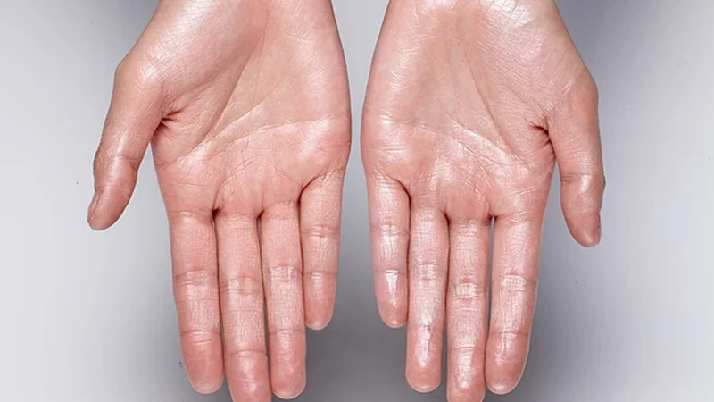 sweatning on hand